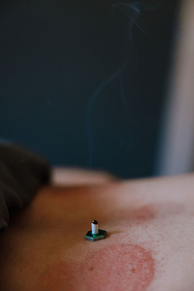 Link to: /pages/moxibustion