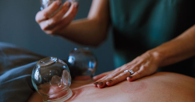 Acupuncture / TCM (Traditional Chinese Medicine)